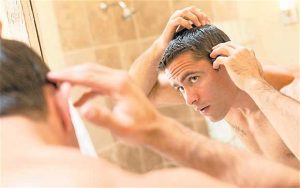 How hair loss happens | Pro Hair Labs